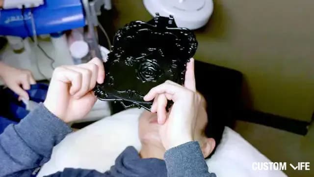 メンズTBCでヒゲ脱毛後の編集部員