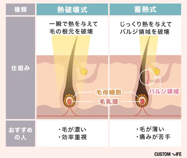 熱破壊式と蓄熱式の脱毛機の違い