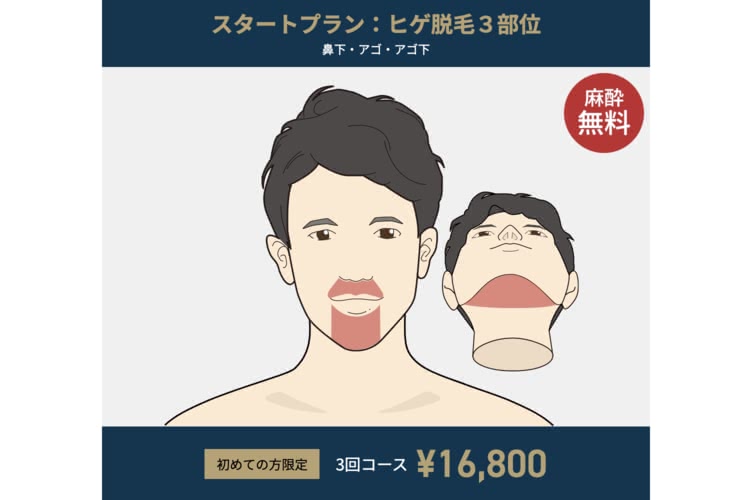 ゴリラクリニック,スタートプラン