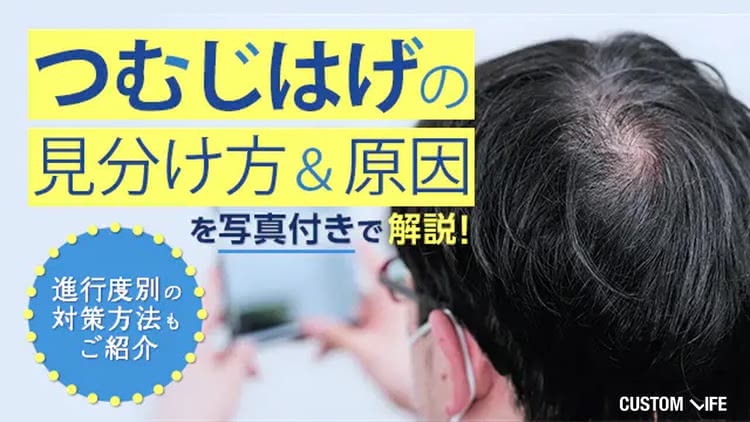 【写真付き】つむじはげの見分け方＆原因を解説！初期から重度まで6つの対策もご紹介