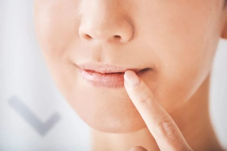 唇にできるシミの原因と消す方法は？｜対策＆皮膚科のシミ取りレーザーを解説