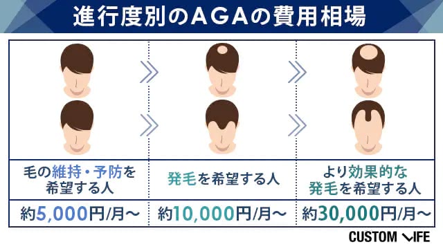 AGAの進行度別の治療費用