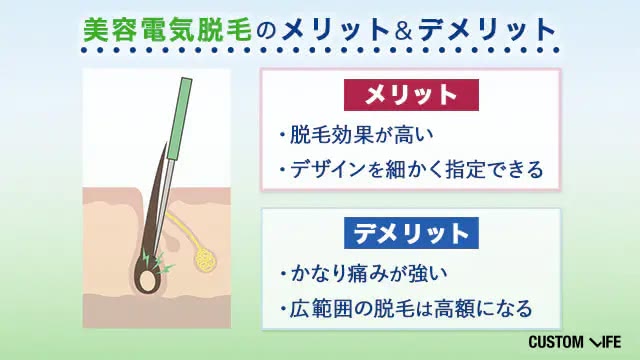 美容電気脱毛のメリット・デメリット