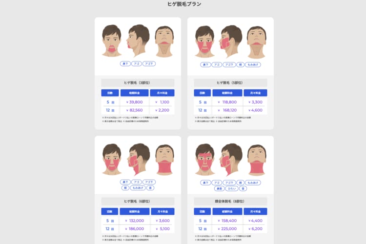 ヒゲ脱毛,体験,レジーナクリニックオム