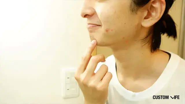 ヒゲ脱毛のトラブルに悩む男性