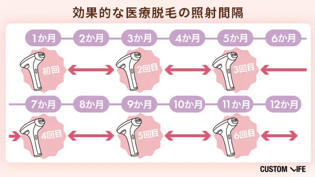 効果的な医療脱毛の照射間隔