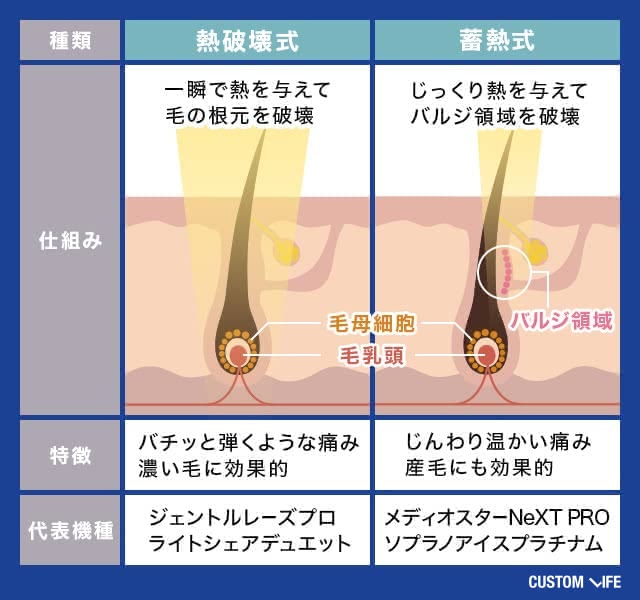 熱破壊式と蓄熱式の脱毛器の違い