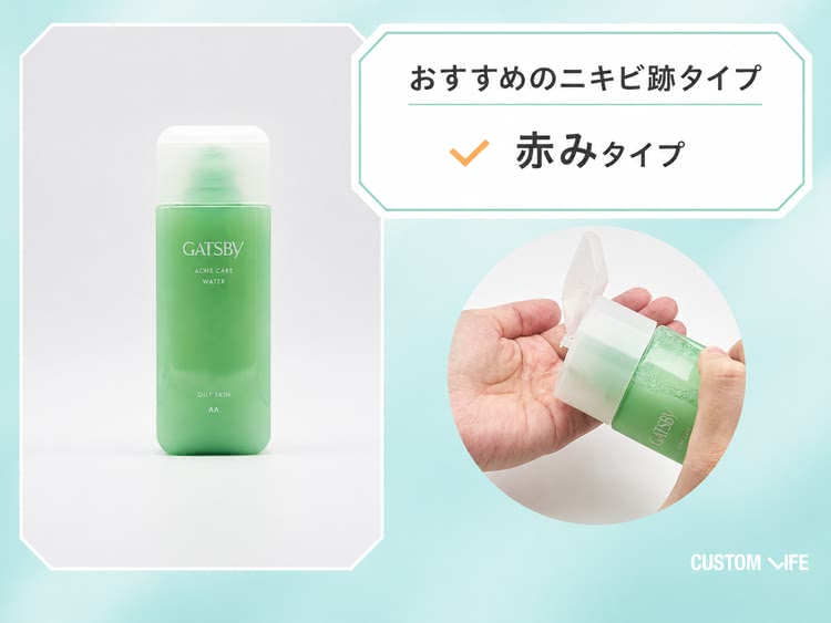 ニキビ跡,化粧水 ギャツビー
