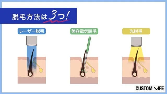 京都,おすすめ,ヒゲ脱毛,探し方