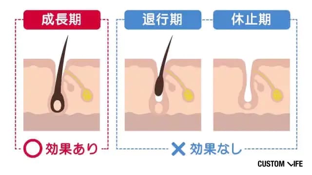 毛周期
