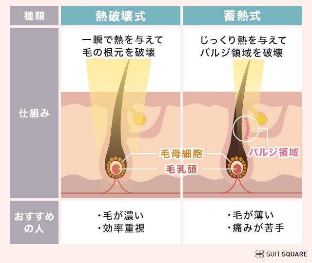 熱破壊式脱毛機と蓄熱式脱毛機の違い