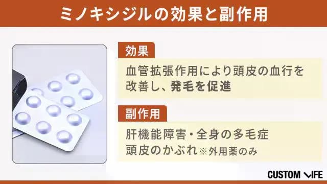 ミノキシジルの効果と副作用をまとめた画像