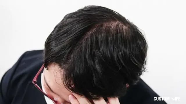 AGA治療の効果が得られない男性