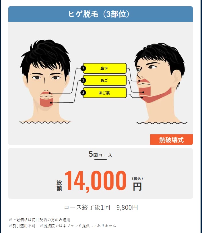 メンズリゼヒゲ三部位プラン