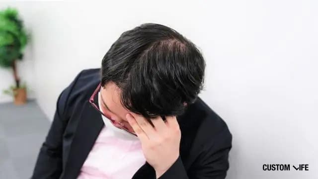 AGAの副作用に悩む男性
