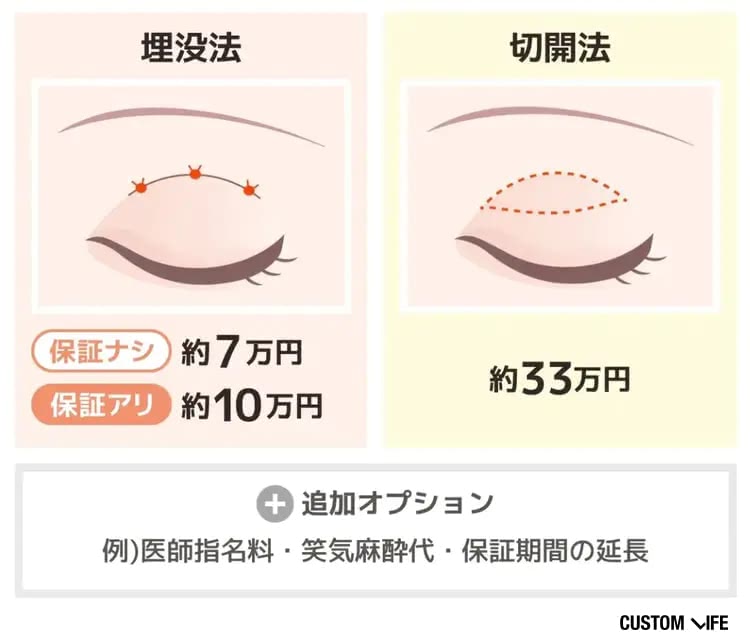 二重整形の料金相場