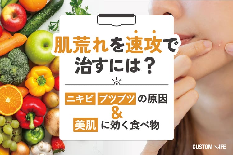 肌荒れを即効で治すには？ニキビ・ブツブツの原因＆美肌に効く食べ物