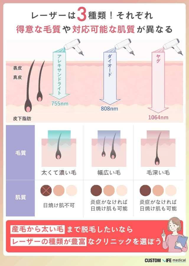 医療脱毛クリニックの選び方①脱毛機