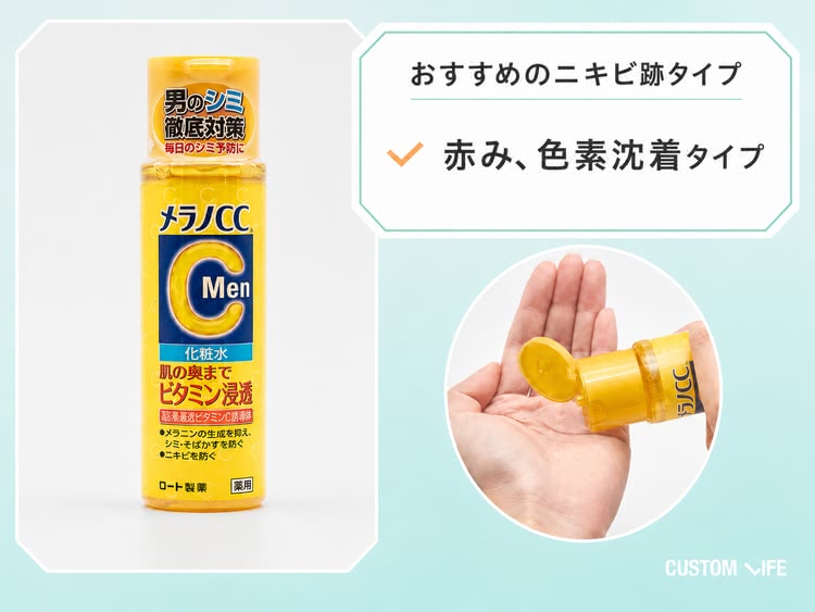 ニキビ跡,化粧水,メラノCC