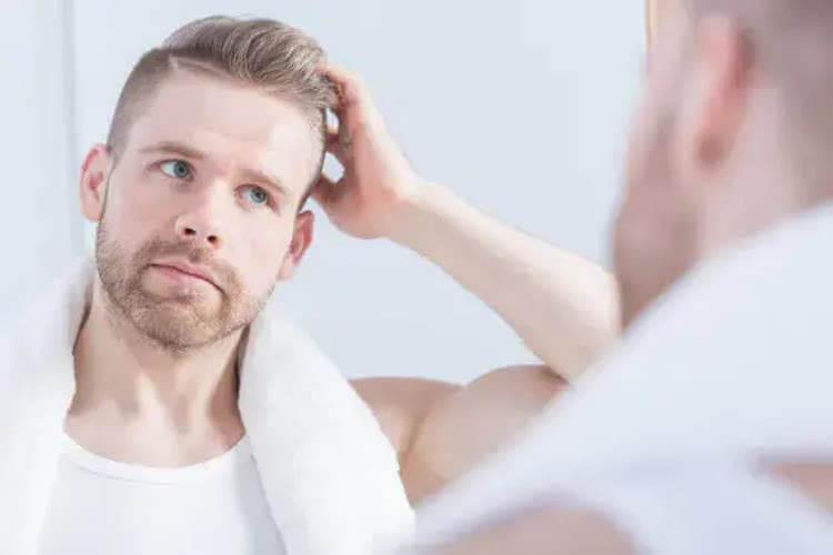 AGAとは？│薄毛の原因・対策・治療法をわかりやすく徹底解説
