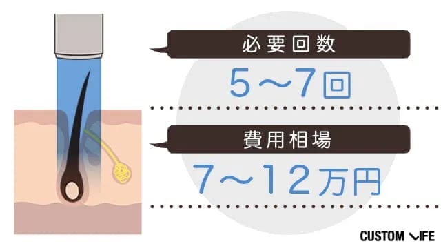 胸毛をレーザー脱毛する場合の費用