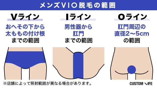 VIO脱毛の照射範囲