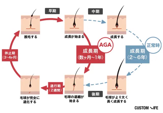 AGAの人のヘアサイクル