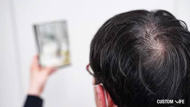 薄毛を気にする男性