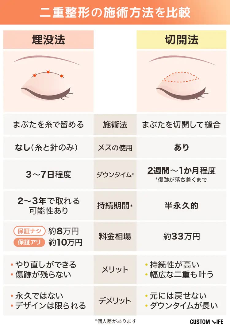 埋没法と切開法の違いを解説する比較表