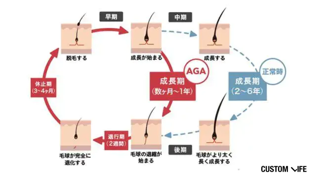 薄毛男性のヘアサイクル