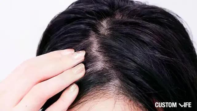 びまん性脱毛の女性