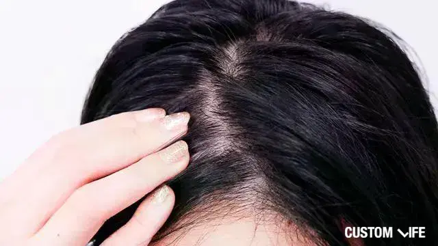 薄毛を気にしている女性のイメージ画像