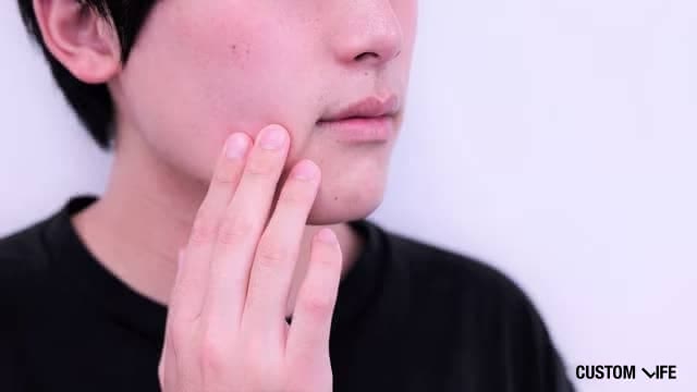 肌荒れしている男性のイメージ