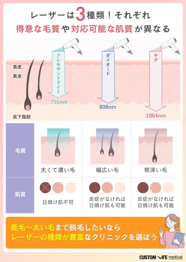 熱破壊式と蓄熱式の違い
