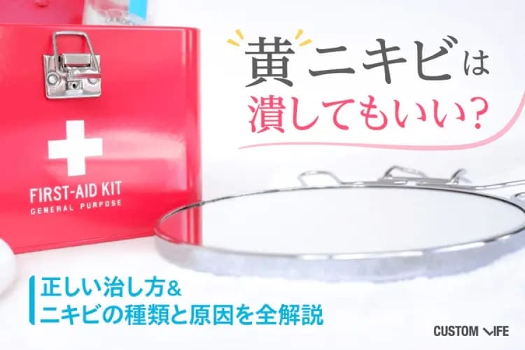 黄ニキビは潰してもいい？正しい治し方＆ニキビの種類と原因を全解説