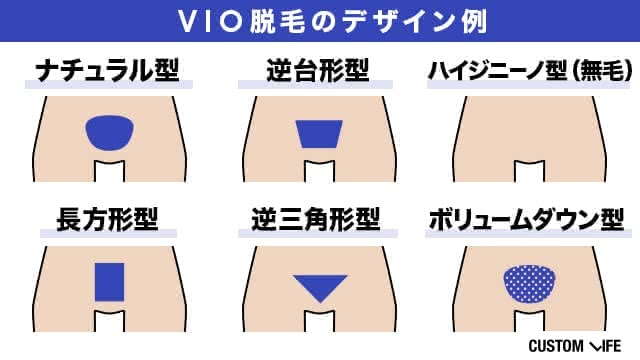 VIO脱毛のデザイン例6種類