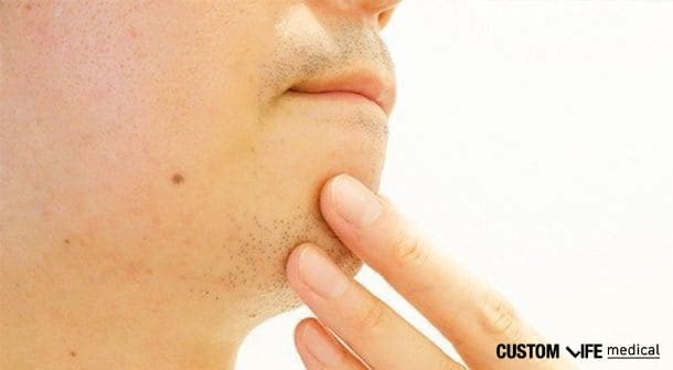 名古屋でメンズ脱毛がおすすめのクリニック