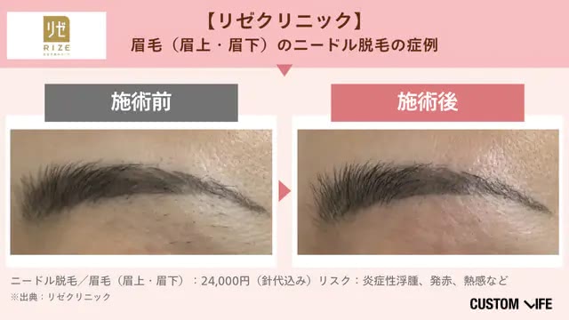 リゼクリニックの症例画像
