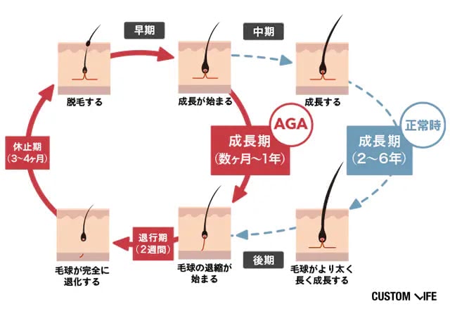 AGAのヘアサイクルを表したイラスト