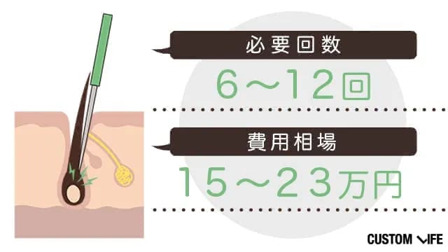 胸毛を美容電気脱毛する場合の費用