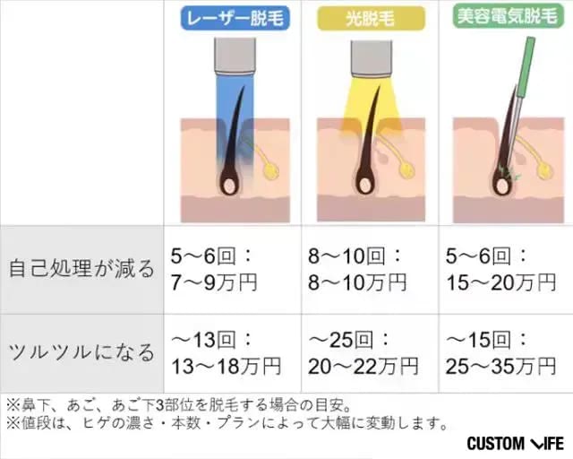 ヒゲ脱毛 値段