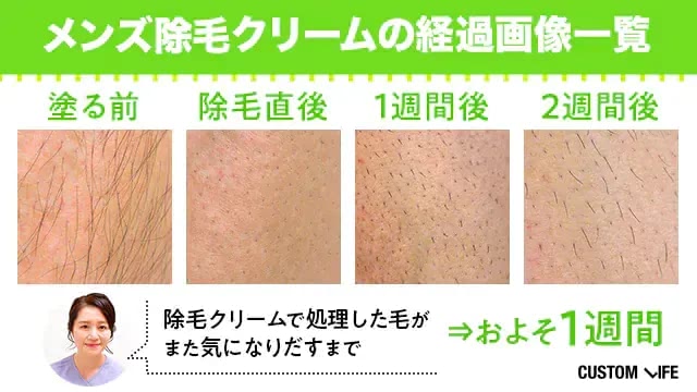 メンズ除毛クリームを使った毛穴のビフォーアフター
