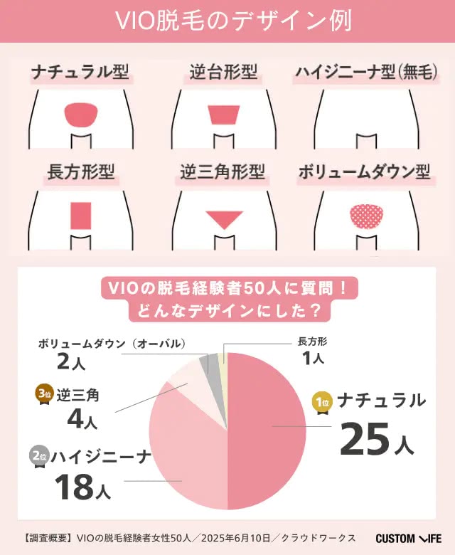 VIOのデザイン
