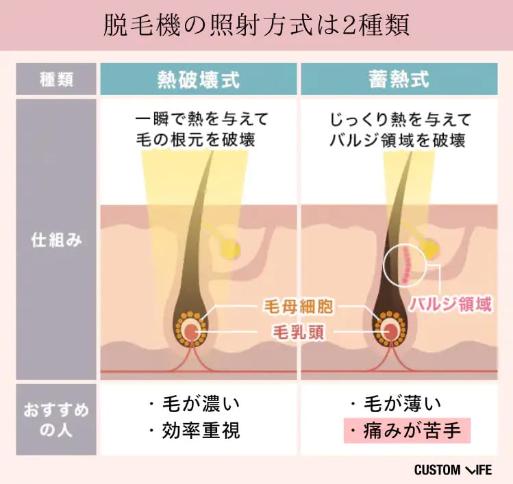 痛みが苦手なら蓄熱式がおすすめ