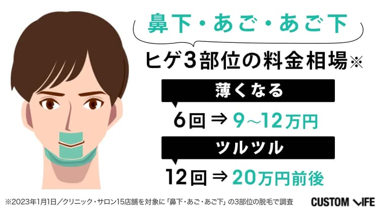 ヒゲの永久脱毛の部位と料金・回数の相場を示すイラスト