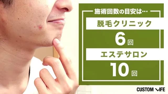 サロンとクリニックのヒゲ脱毛の施術回数の目安