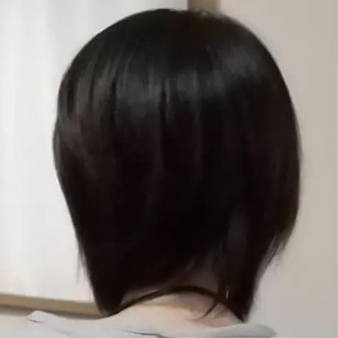 リゼクリニックの経験者