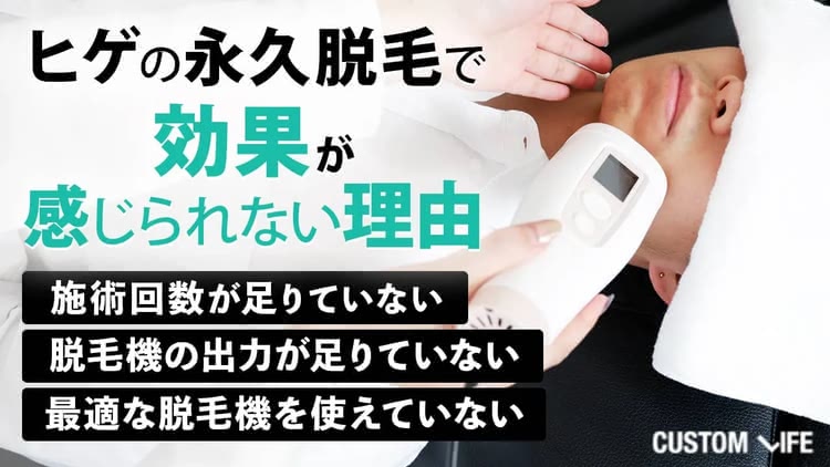 ひげの脱毛をする男性