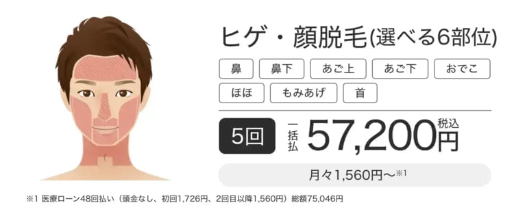 エミナルクリニックメンズ（メンズエミナル）のヒゲ脱毛3部位セレクトプラン