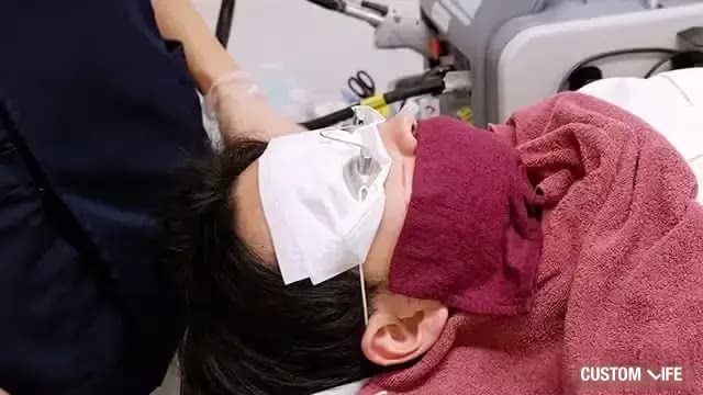 メンズリゼの脱毛後にクールダウン